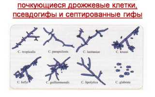 Что такое candida spp: симптомы и лечение вируса