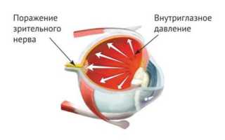 Дуотрав – аналоги глазных капель, инструкция по применению и рекомендации