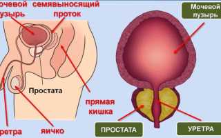 Чем отличаются простатит и аденома простаты: основные аспекты