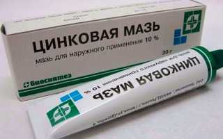 Лечение геморроя цинковой мазью: инструкция и отзывы от специалистов