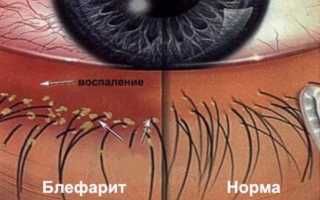Офтоципро – мазь глазная: инструкция по применению, аналоги и рекомендации