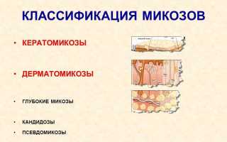 Классификация микозов кожи: симптомы и лечение