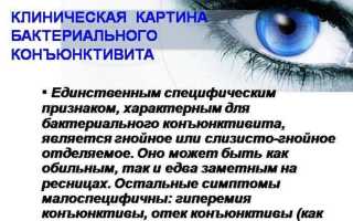 Бактериальный конъюнктивит у детей: лечение ребенка в домашних условиях и советы по профилактике