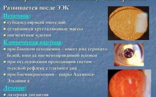 Повторная катаракта после замены хрусталика: причина осложнения после удаления и его последствия