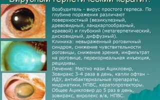 Вирусный кератит – тяжелый недуг или легкое недомогание, причины и лечение