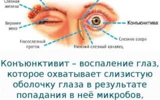 Конъюнктивит – лечение у взрослых: медикаменты для быстрого лечения вирусного типа и профилактики