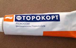 Мазь Фторокорт: состав, инструкция по применению и аналоги