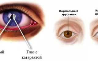 Броксинак – инструкция по применению, дешевые аналоги и заменители для здоровья
