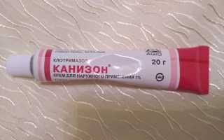 Мазь Канизон: описание и инструкция по применению
