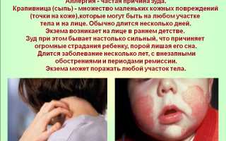 Причины жжения кожи и симптомы заболеваний