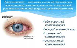 Окуметил – глазные капли: инструкция по применению, состав и дешевые аналоги для здоровья глаз