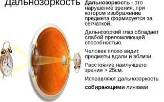 Как вернуть зрение в домашних условиях: лечение и упражнения для глаз, советы специалистов