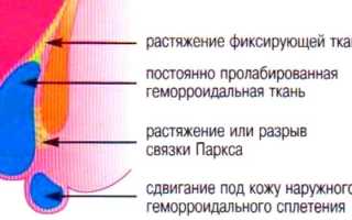 Препарат Флебодиа 600: инструкция по применению при геморрое и отзывы пользователей
