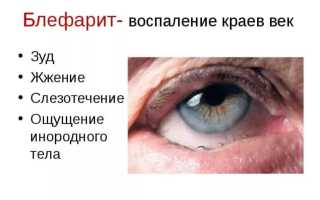 Тобрадекс: инструкция по применению глазных капель взрослым и для детей в различных случаях