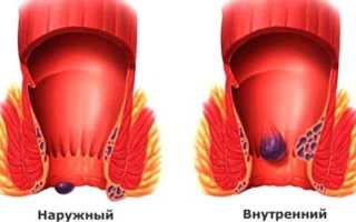 Инструкция по применению препарата Венарус для эффективного лечения