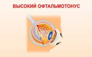 Траватан – аналоги капель при глаукоме, инструкция по применению и рекомендации