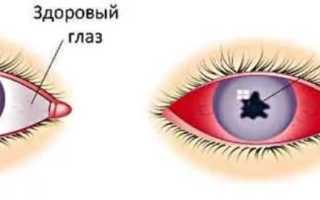 Окомистин – инструкция по применению для детей, дешевые аналоги и рекомендации