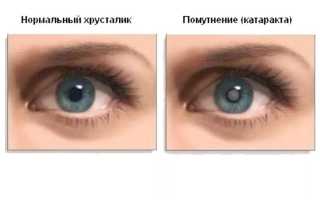 Глазные капли Бестоксол: инструкция, показания к применению, побочные реакции и рекомендации