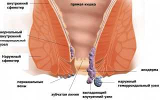 Можно ли безболезненно сходить в туалет при геморрое: советы и рекомендации