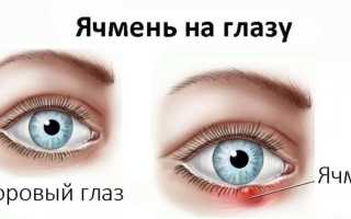 Тетрациклиновая мазь глазная: состав и инструкция по применению для здоровья глаз