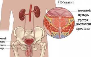 Свечи Индометацин при простатите: инструкция и отзывы пациентов