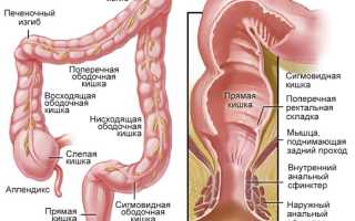 Что такое полип в прямой кишке: симптомы и лечение, важные аспекты