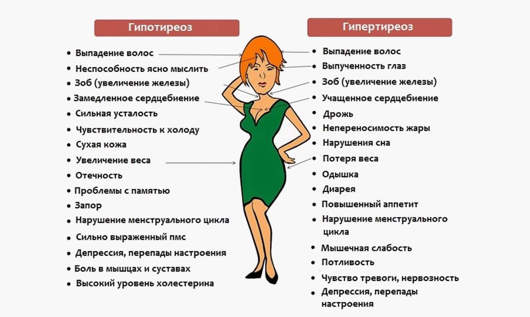 Женщинам при прогрессировании у них гипотиреоза свойственны значительные нарушения месячного цикла