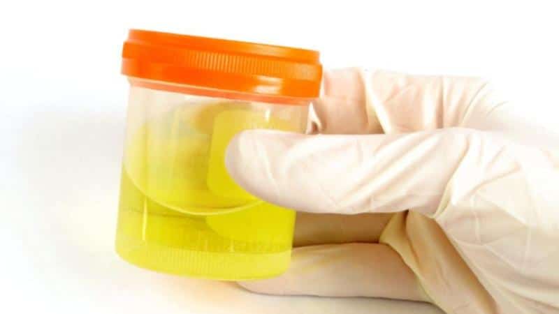 аденома простаты лечение простатит