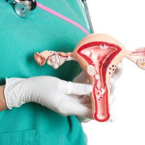 Что такое аденоматозные полипы и как их лечить