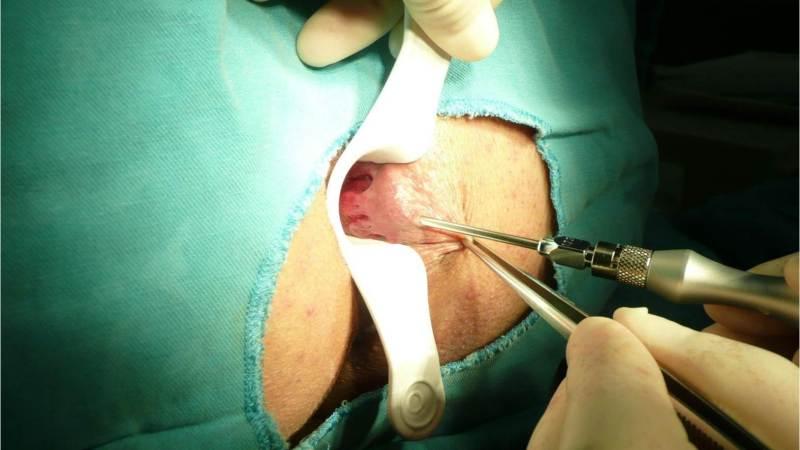 мокнет в заднем проходе у мужчин