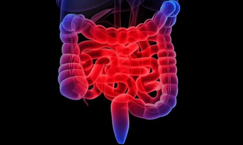 Лечение колита в домашних условиях