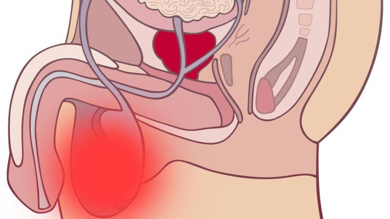 почему колит внизу живота левый бок