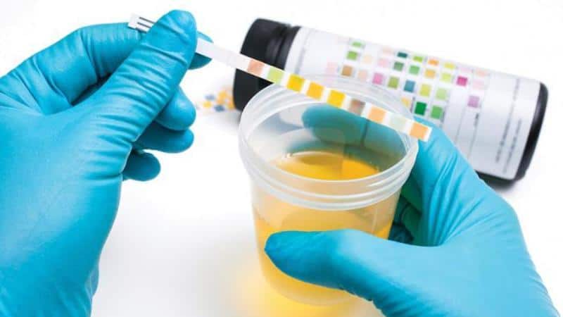 колит левый бок внизу живота у мужчины