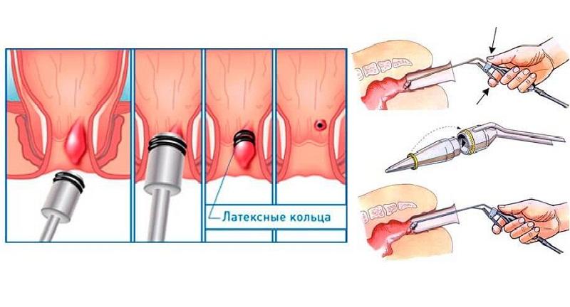 как должен выглядеть здоровый анус фото