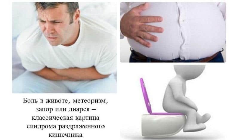 Симптомы синдрома раздраженного кишечника