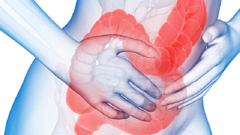 причины синдрома раздраженного кишечника