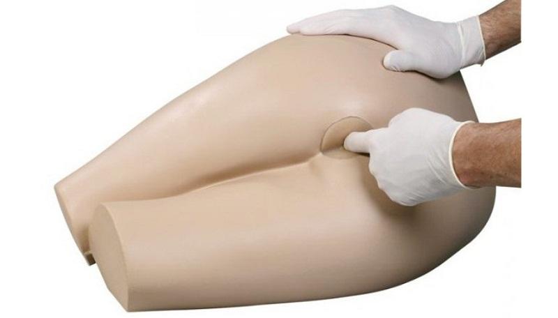 в заднем проходе как будто кол что это