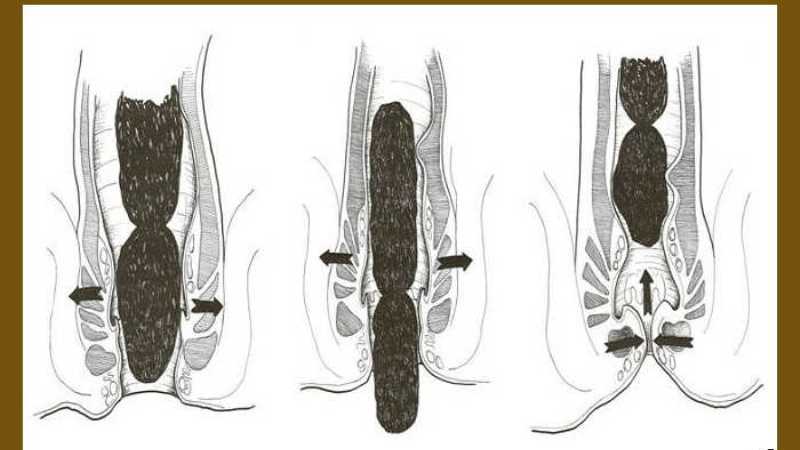 акт дефекации что это такое
