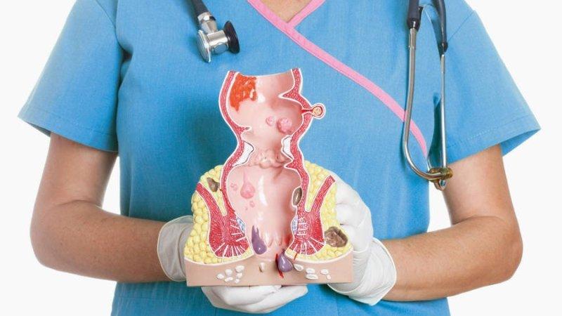 диета после операции анальной трещины