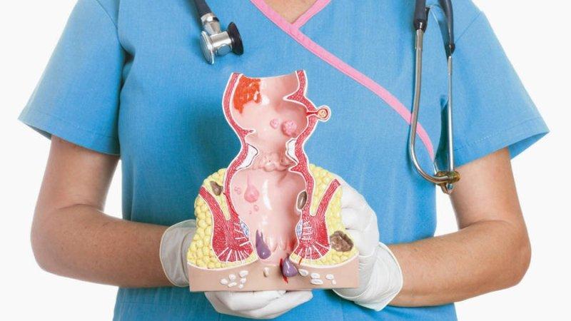 диклофенак от геморроя отзывы