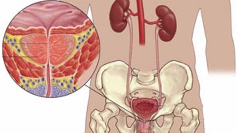 какие продукты полезны при простатите