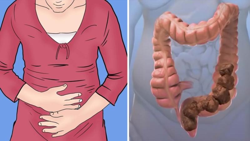 лечение у пожилых при запорах