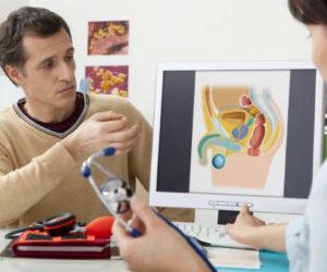 Препарат Доксициклин при лечении простатита: инструкция и отзывы