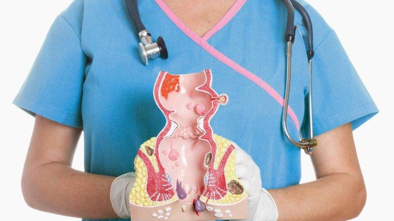 народные способы лечения геморроя