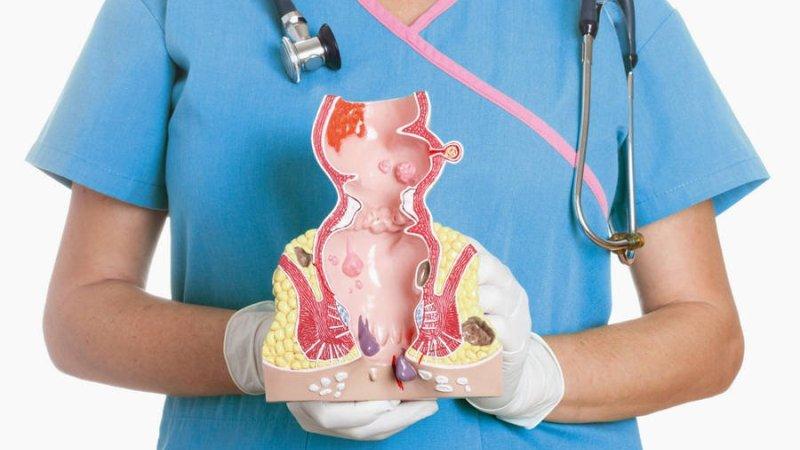 геморрой симптомы у женщин при беременности