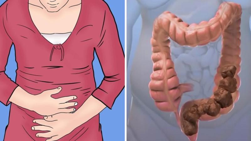 как лечить геморрой у подростков 16 18 лет