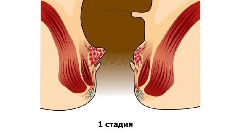 гимнастика по кегелю