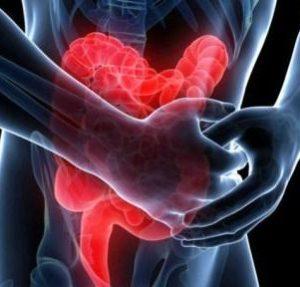 лечение ишемического колита кишечника