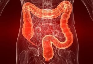 лечебная тактика при диагностировании ишемического колита у пожилых больных