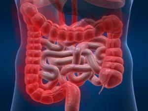 ишемический колит у пожилых людей